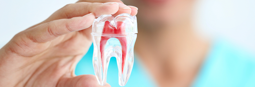 Read more about the article What is a Root Canal?