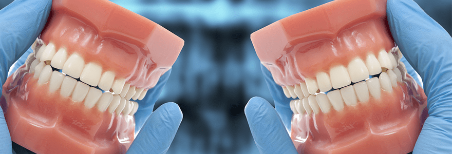Read more about the article How Do You Know That You Need Dentures?