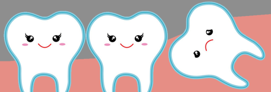 Read more about the article How Many Wisdom Teeth Does a Person Have?