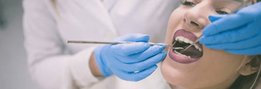 You are currently viewing Treatment for Chipped or Broken Teeth